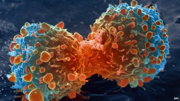 The Real Truth about What Causes Cancer and Why Doctors Constantly Ignore It